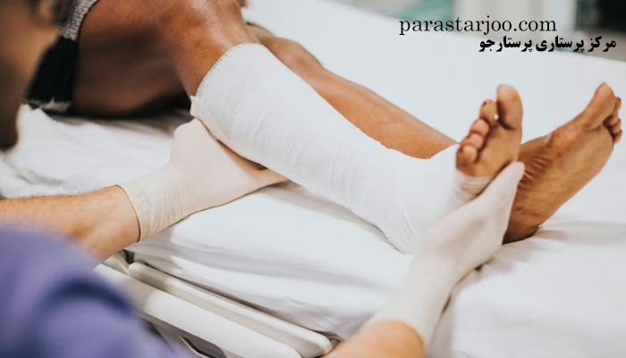 گچ گرفتن دست و پا در منزل کرج